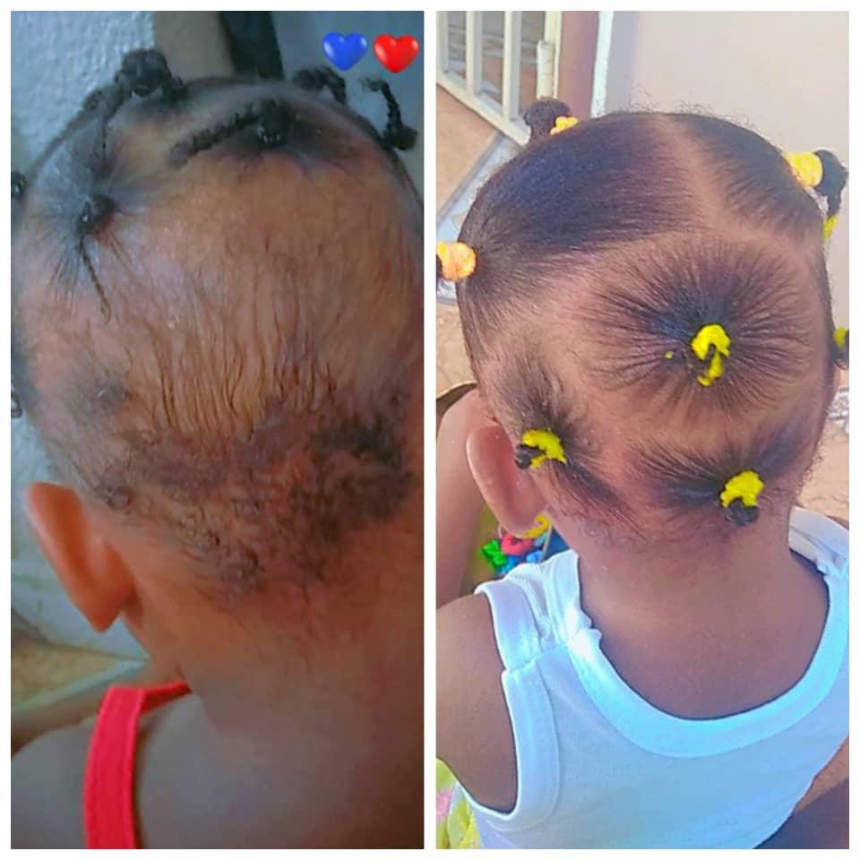 HUILE BABY 100% EFFICACE - Eezgrace 2